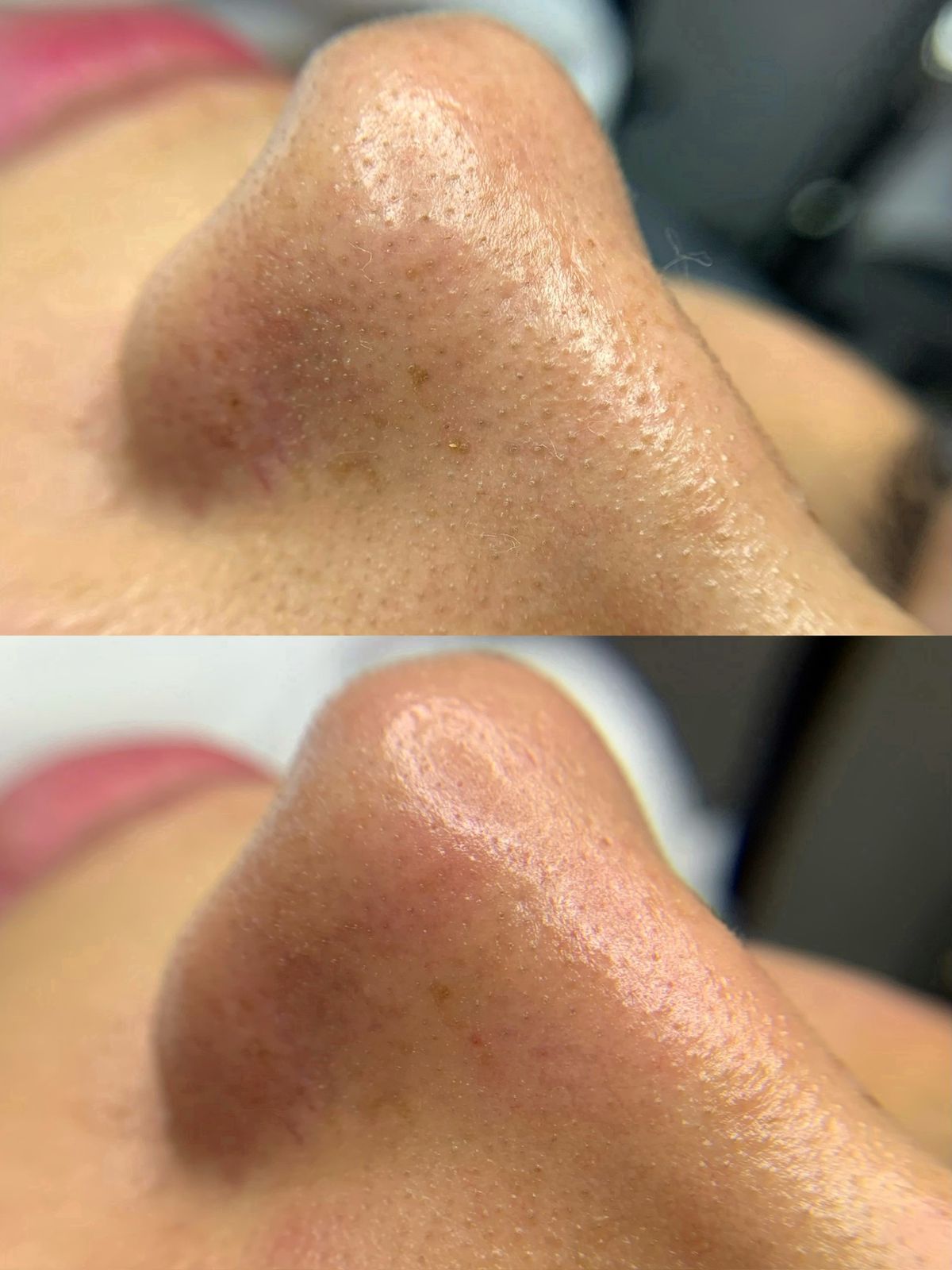 Correção de formato em design de sobrancelhas